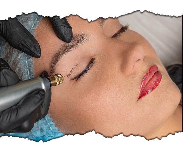 microneedling rejuvenare faciala