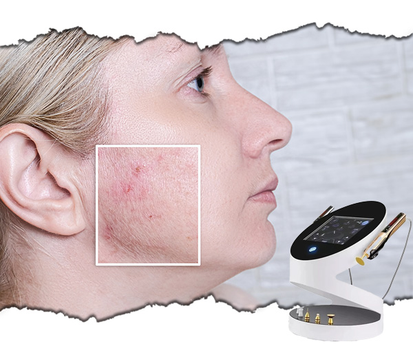 slabire si remodelare corporala