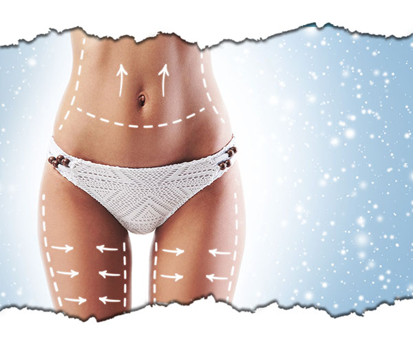 remodelare corporala