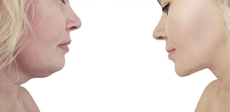 elimina barbia dubla