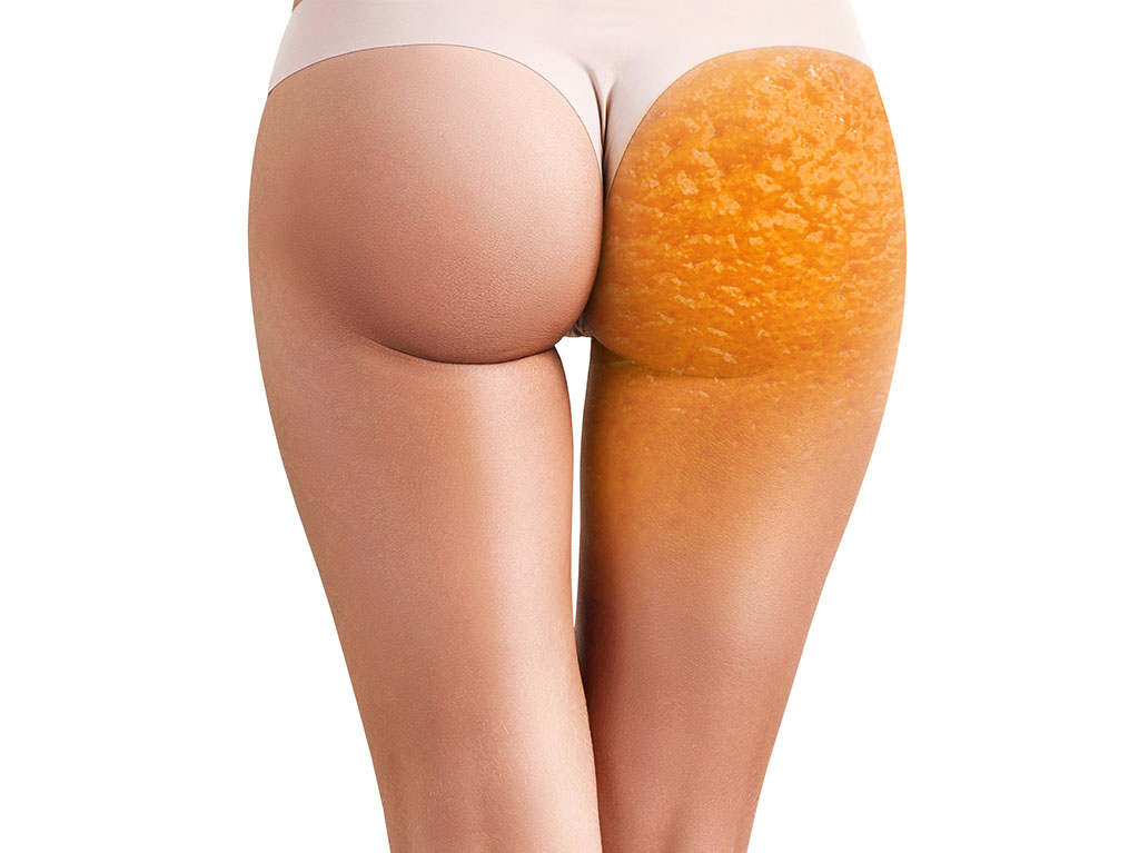 remodelare corporala