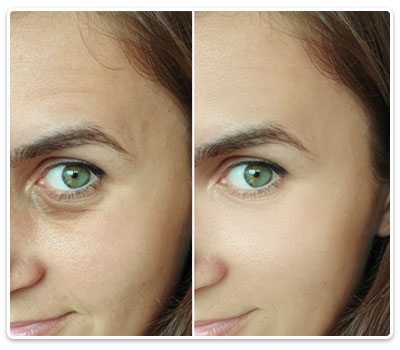 tratament curatare faciala