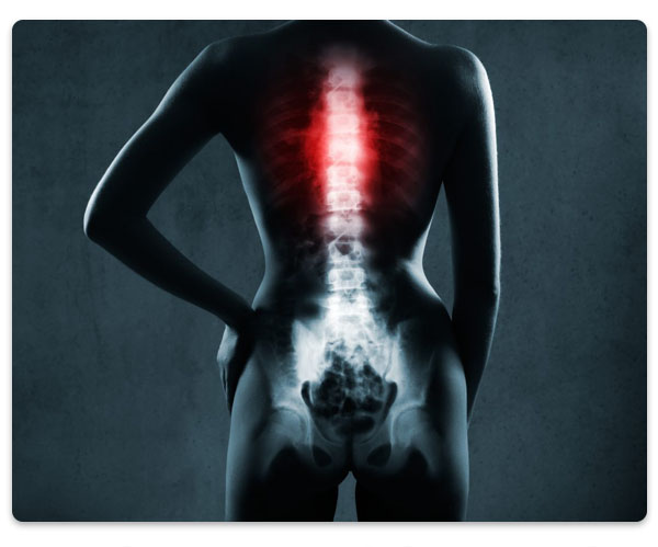 tratament durere de spate