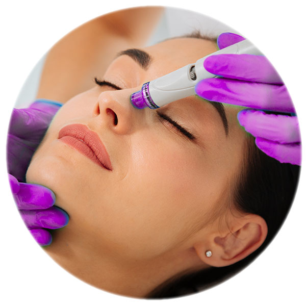 hidradermabraziune sau microdermabraziune