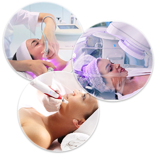 Microneedling elimina cicatricile