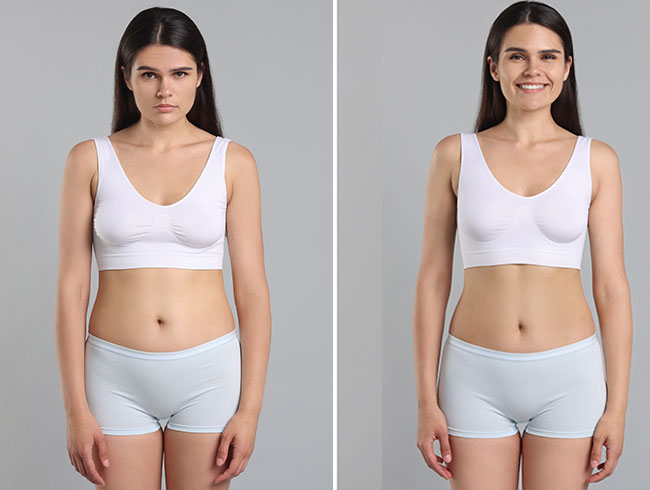 slabire si tonifiere cu EMSlim 