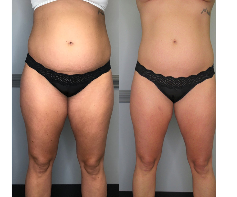 cum sa slabesc rapid