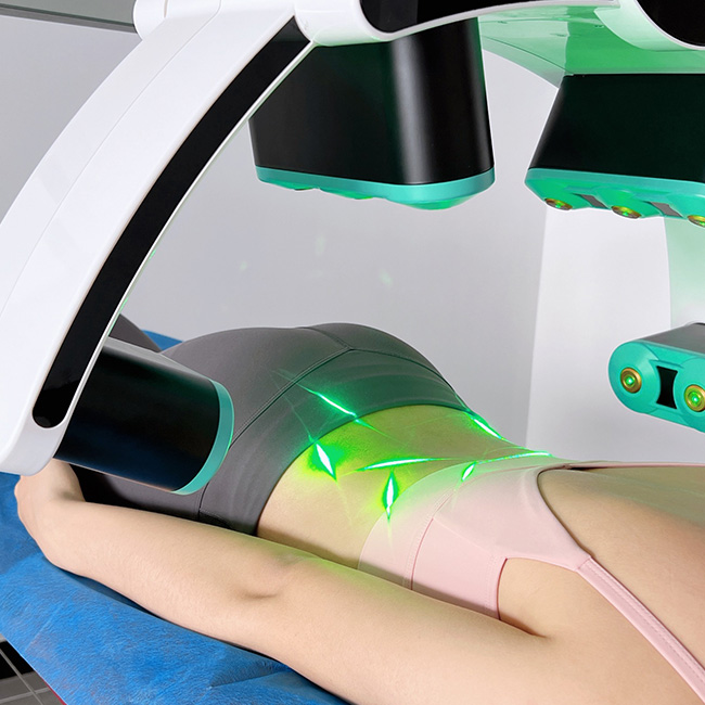 remodelare corporala