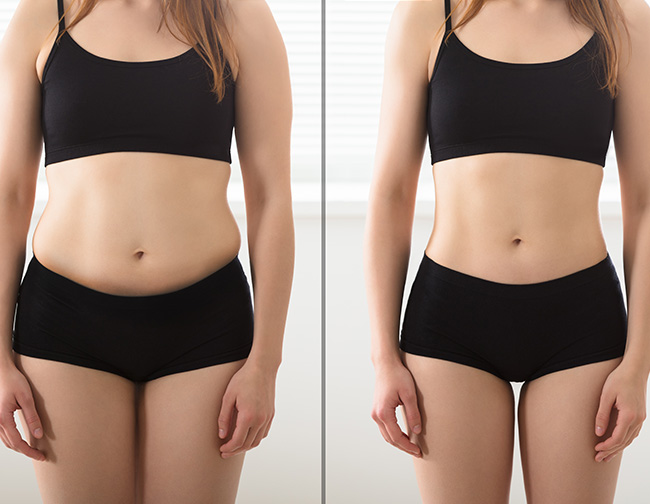 remodelare corporala