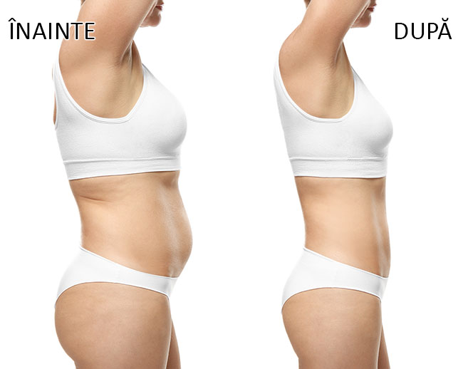 slabire si tonifiere cu EMSlim 