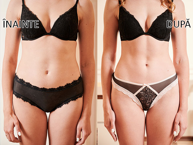 slabire si tonifiere cu EMSlim 