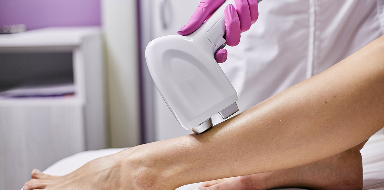 epilare definitiva cu laser in Iasi la SenzoFit