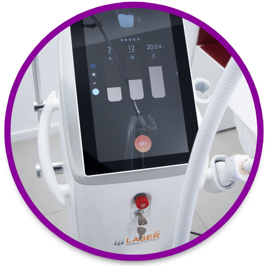 epilare definitiva cu laser in Iasi