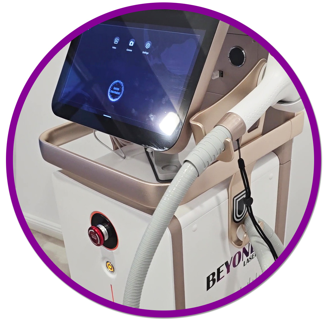 epilare definitiva cu laser in Iasi