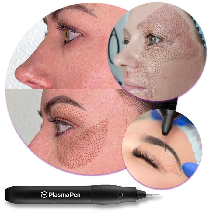 elimina barbia dubla sau gusa